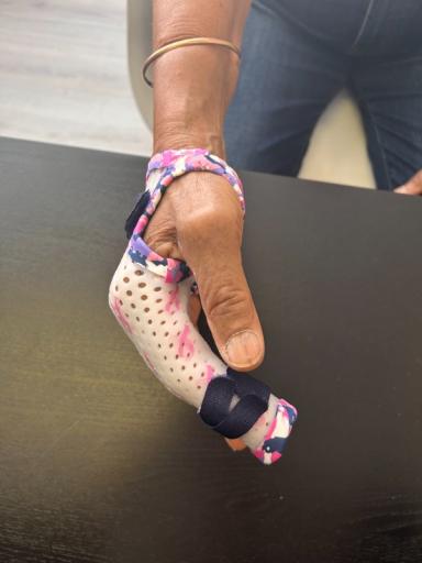 Octobre Rose et les orthèses thermoformées sur mesure pour fracture d'une phalange des doigts